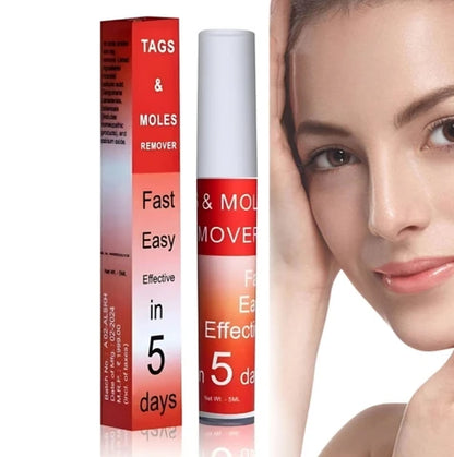 Tags & Mole remover (Buy 1 Get 1 Free )