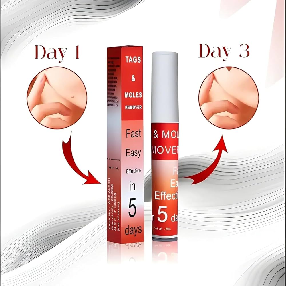 Tags & Mole remover (Buy 1 Get 1 Free )